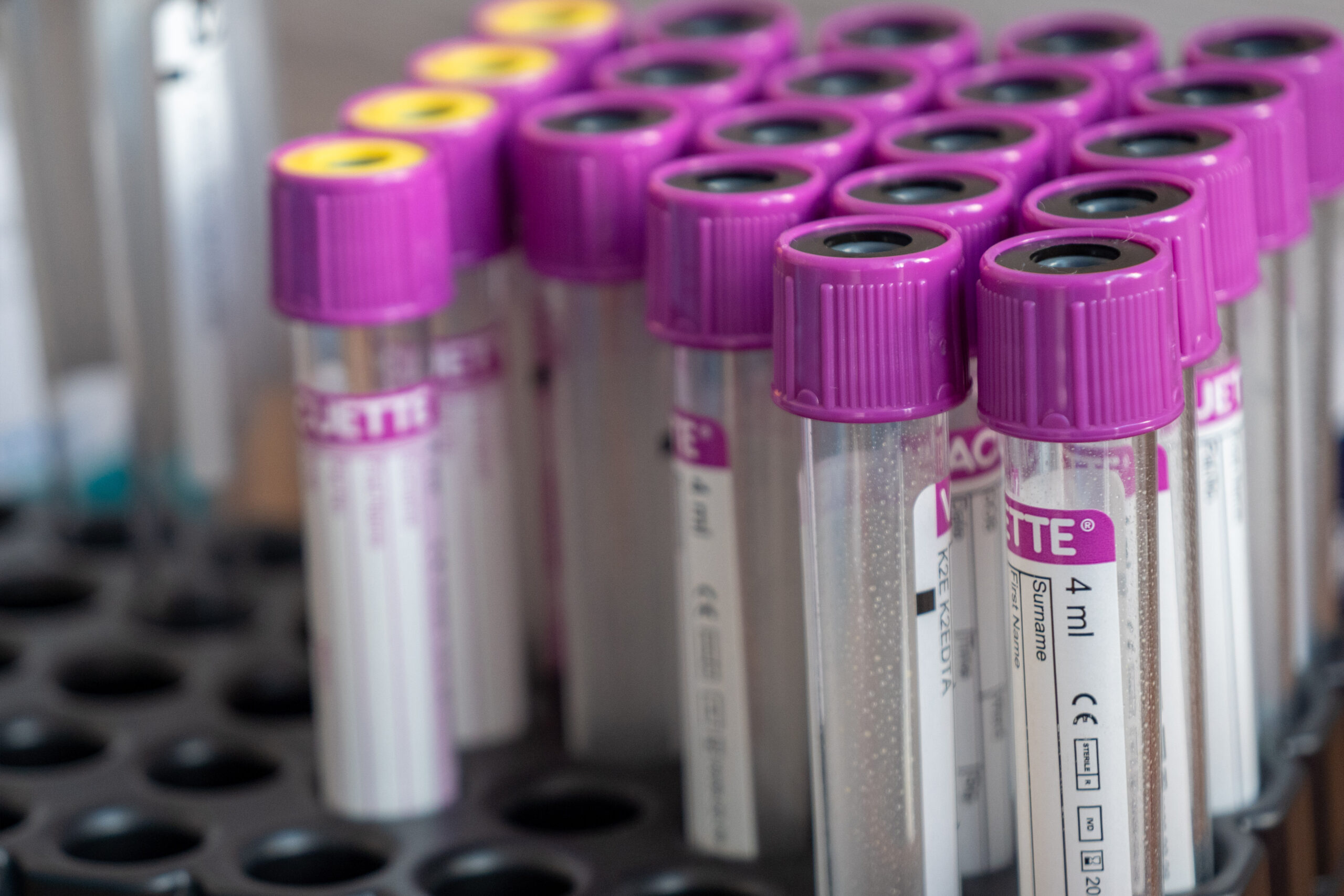 Tests & Results